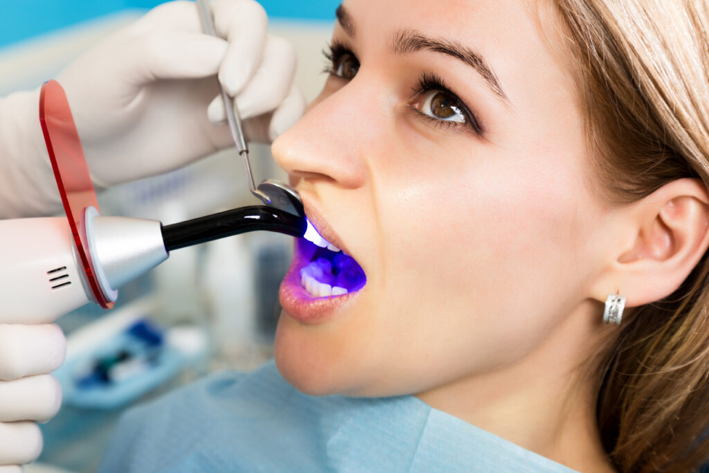 Paciente dental empastando cavidad. Dentista trabajando con lámpara de polimerización dental en cavidad oral.