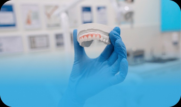 Concepto de sustitución de dientes. Mano que sostiene el modelo dental de los dientes superiores.