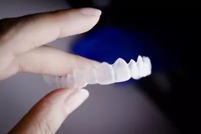 Invisalign braces