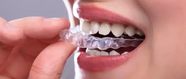 Girl putting on Invisalign braces