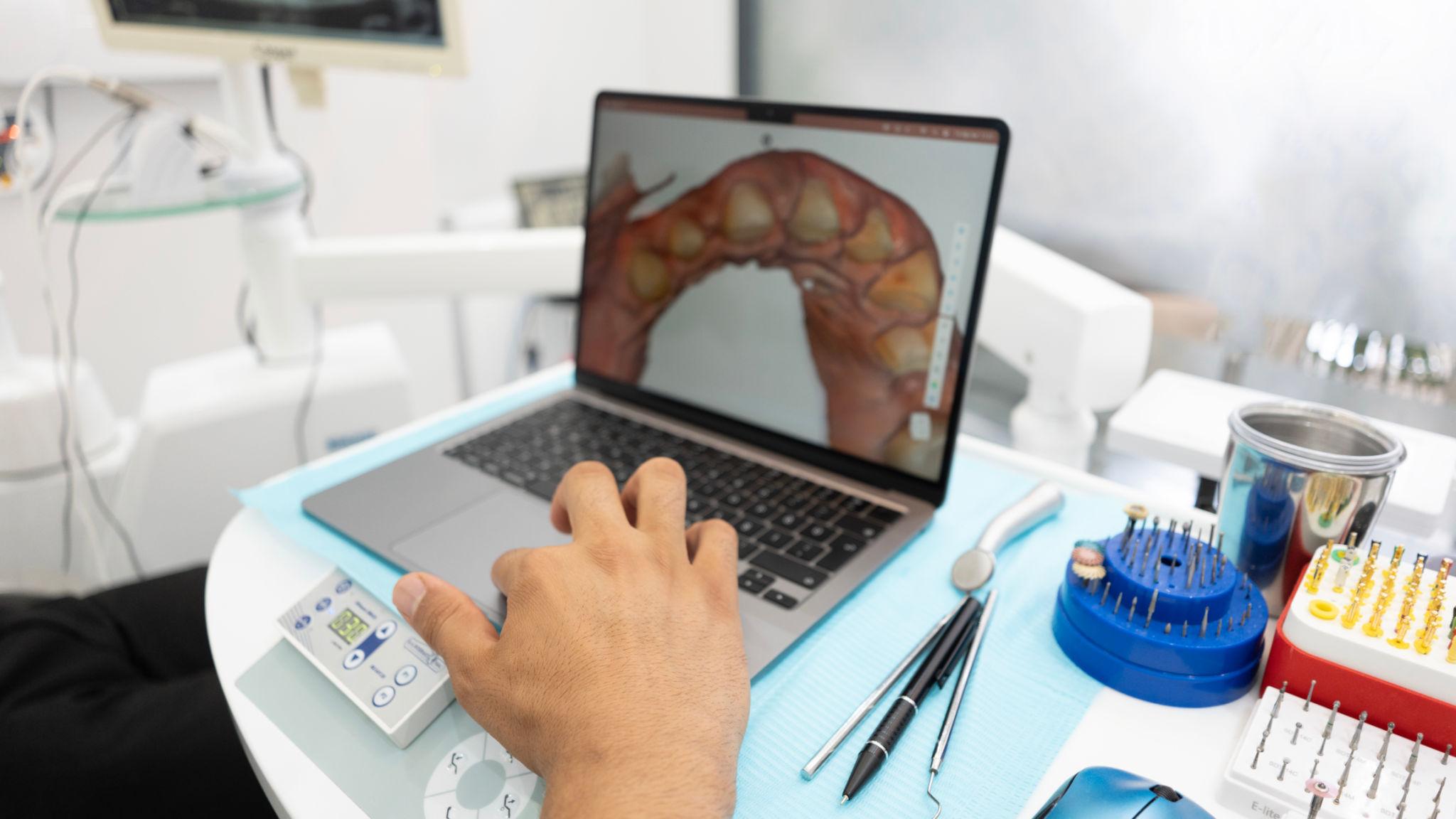All-on-4 Dental Implants in Wilmington - O2 Dental Group - O2 Dental Group All-on-4 Dental Implants in Wilmington