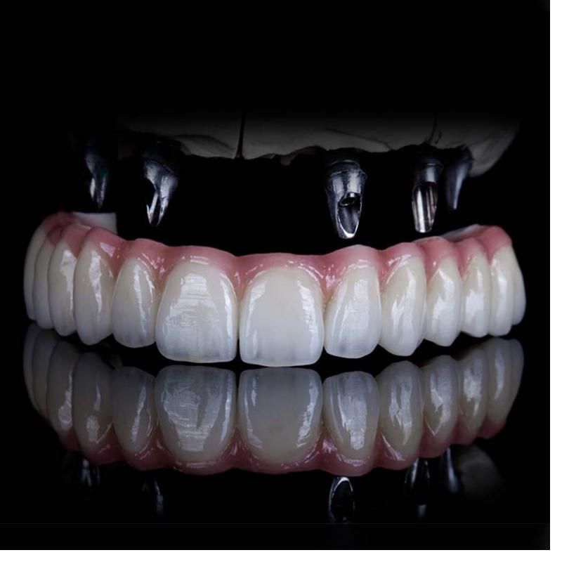 All-on-4 Full-Arch Implants - O2 Dental Group - O2 Dental Group All-on-4 Full-Arch Implants