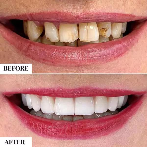 Cosmetic Dentistry NC - O2 Dental Group - O2 Dental Group Cosmetic Dentistry NC