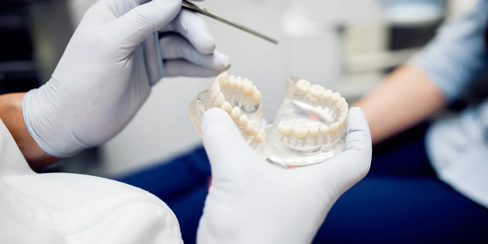 Dental Bridges in Wilmington, NC - O2 Dental Group - O2 Dental Group Dental Bridges in Wilmington, NC