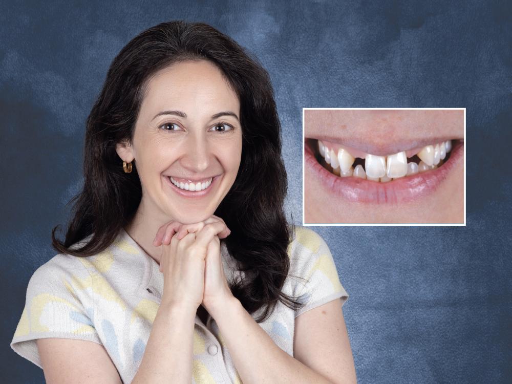 Dental Bridges Consultation Wilmington, NC - O2 Dental Group - O2 Dental Group Dental Bridges Consultation Wilmington, NC
