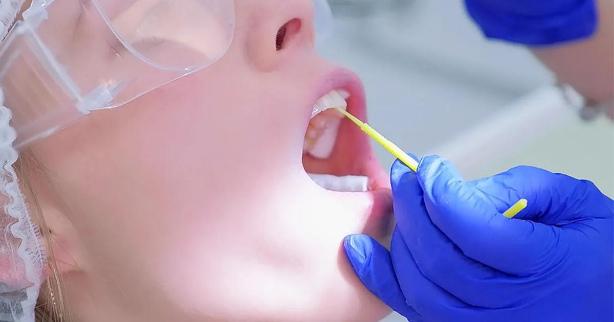 Dental Cleanings in Durham