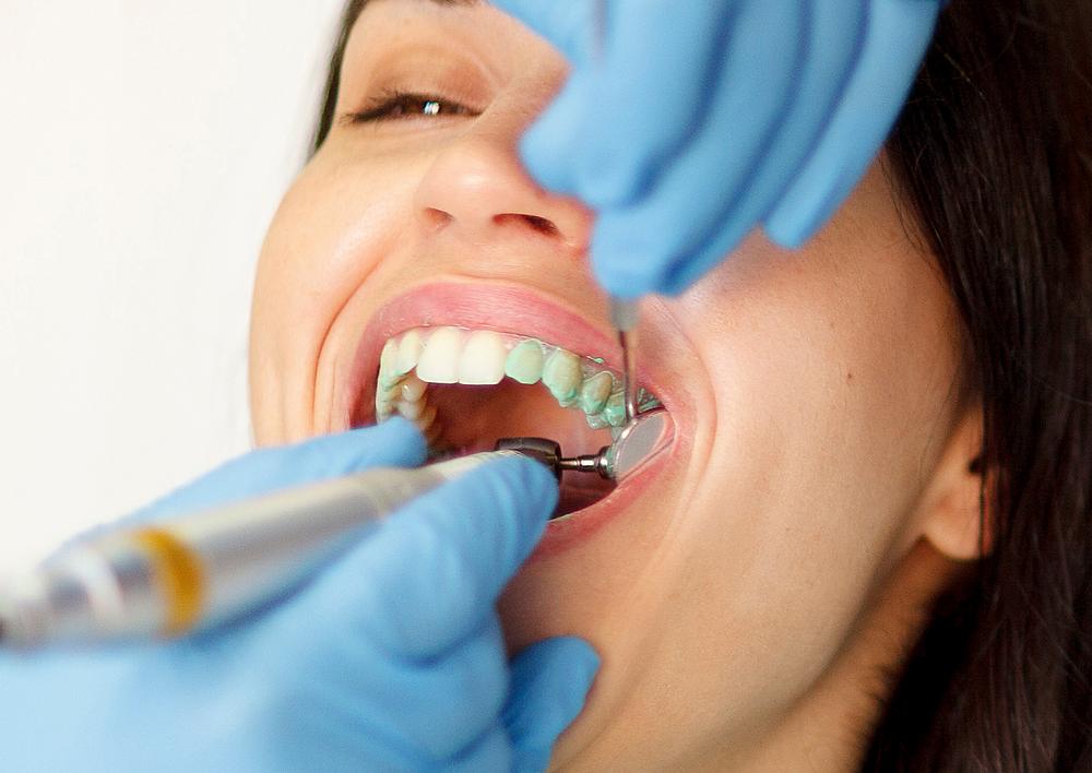Dental Cleanings in Siler City NC