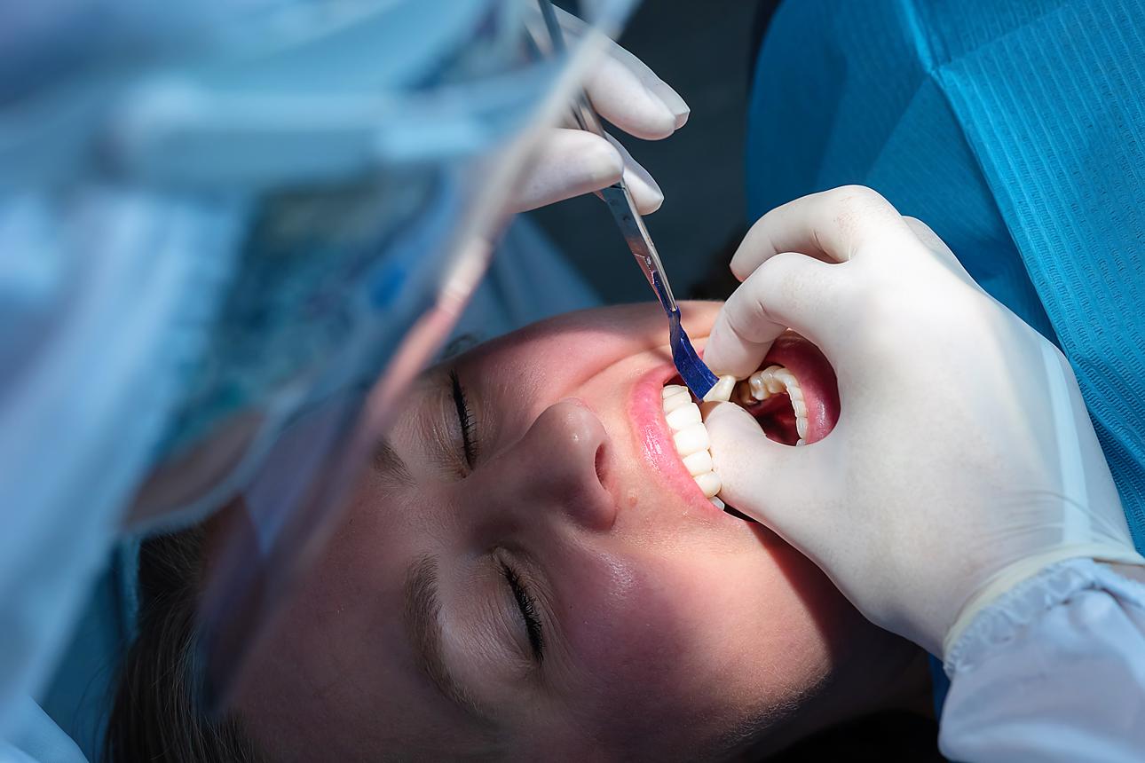 Dental Crowns in Raleigh