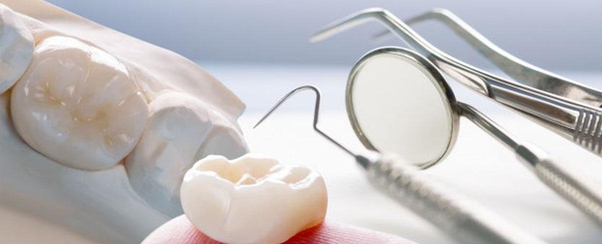 Same-Day Dental Crowns