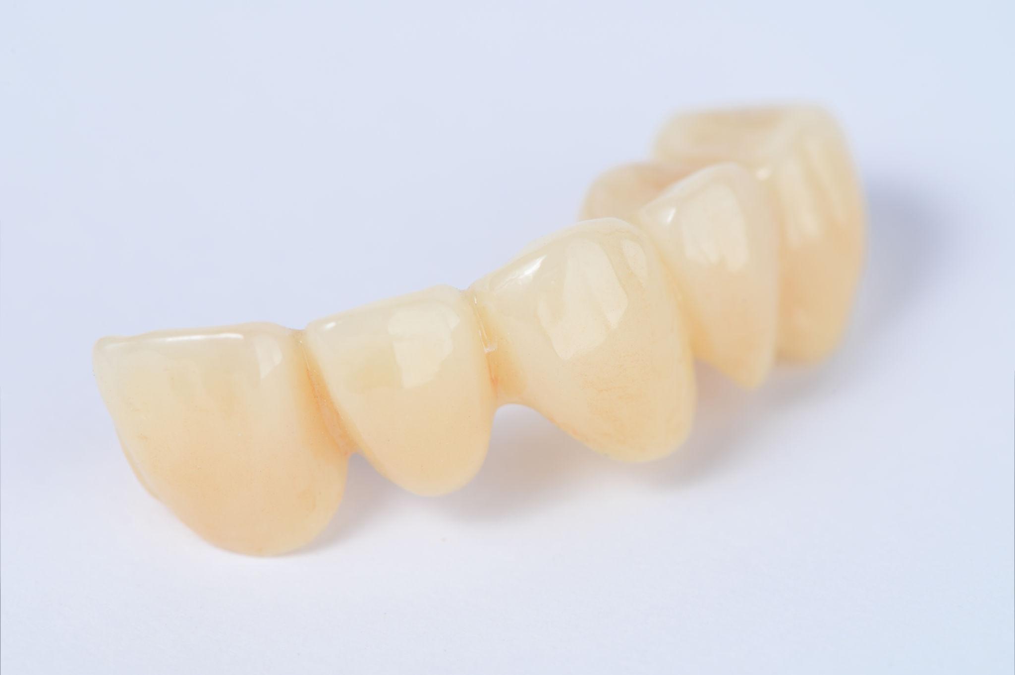 Dental Crowns in Wilmington, NC​