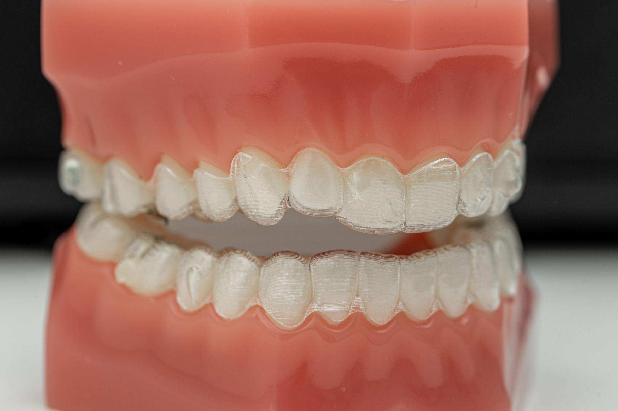 Close-up of a dental model showing upper and lower teeth in occlusion with pink gums.