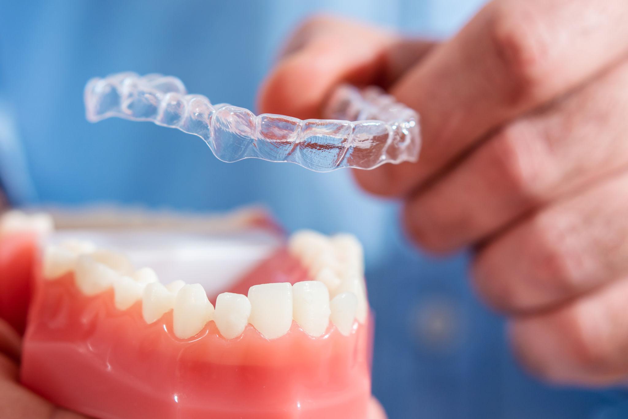 Invisalign Treatment