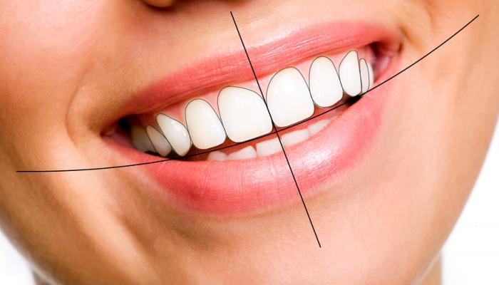 Invisalign Treatment Wilmington - O2 Dental Group - O2 Dental Group Invisalign Treatment Wilmington