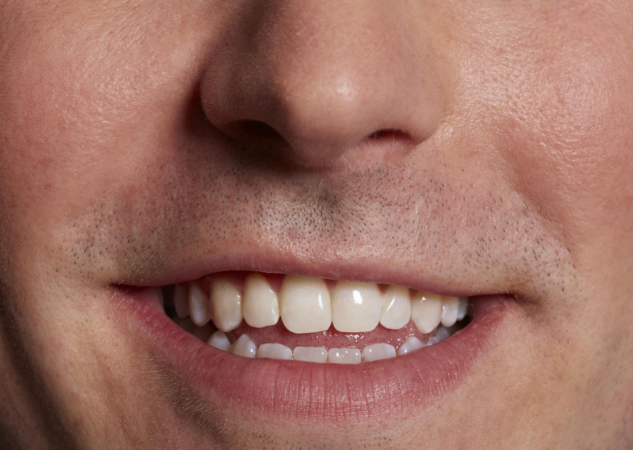 Invisalign consultation Wilmington - O2 Dental Group - O2 Dental Group Invisalign consultation Wilmington