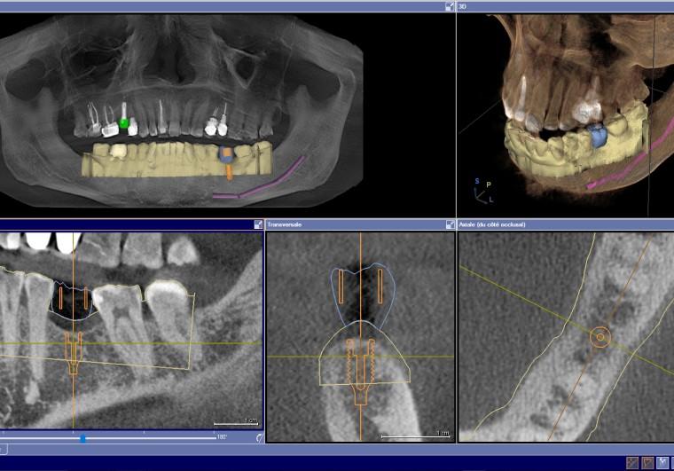 Oral Surgery in Wilmington