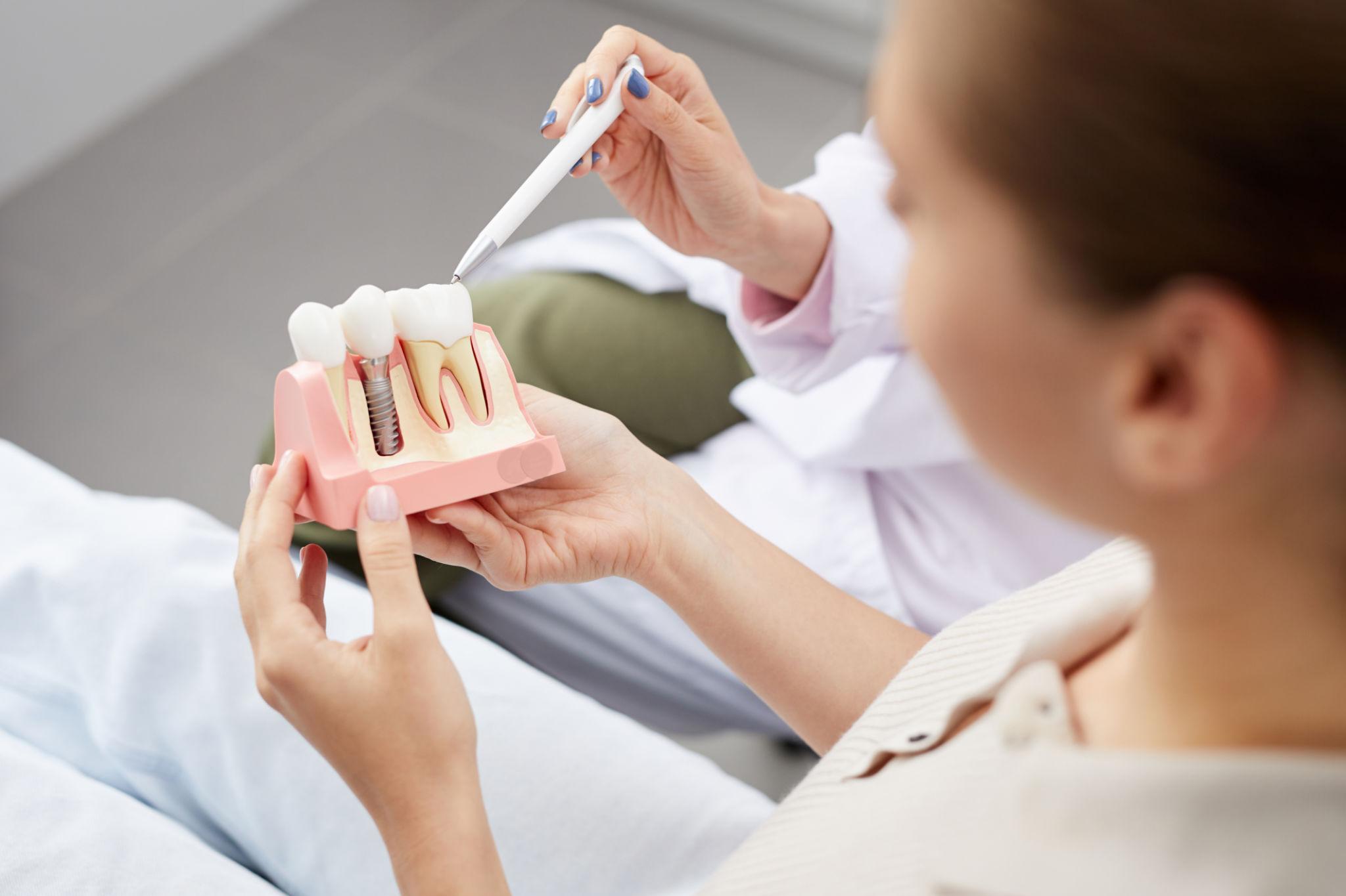 Dentist or student demonstrates implant placement on a jaw model with a stylus tool near teeth model.