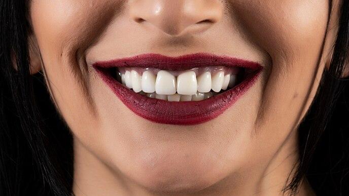 Close-up of a smiling mouth with dark red lipstick, showing white teeth and dimples on the cheeks.