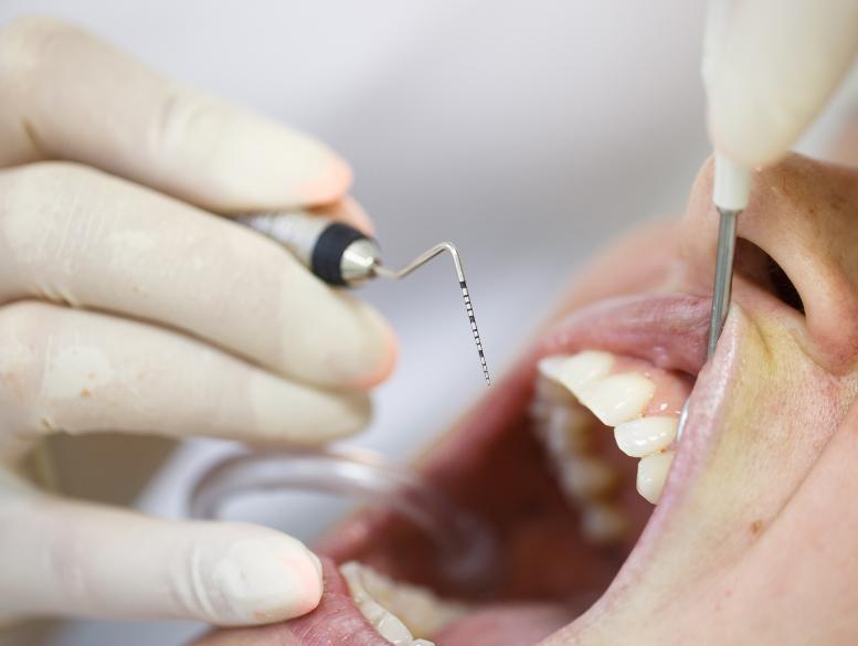 Periodontal Gum Disease Treatment