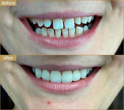 - O2 Dental Group - O2 Dental Group cosmetic dental clinic Fayetteville NC