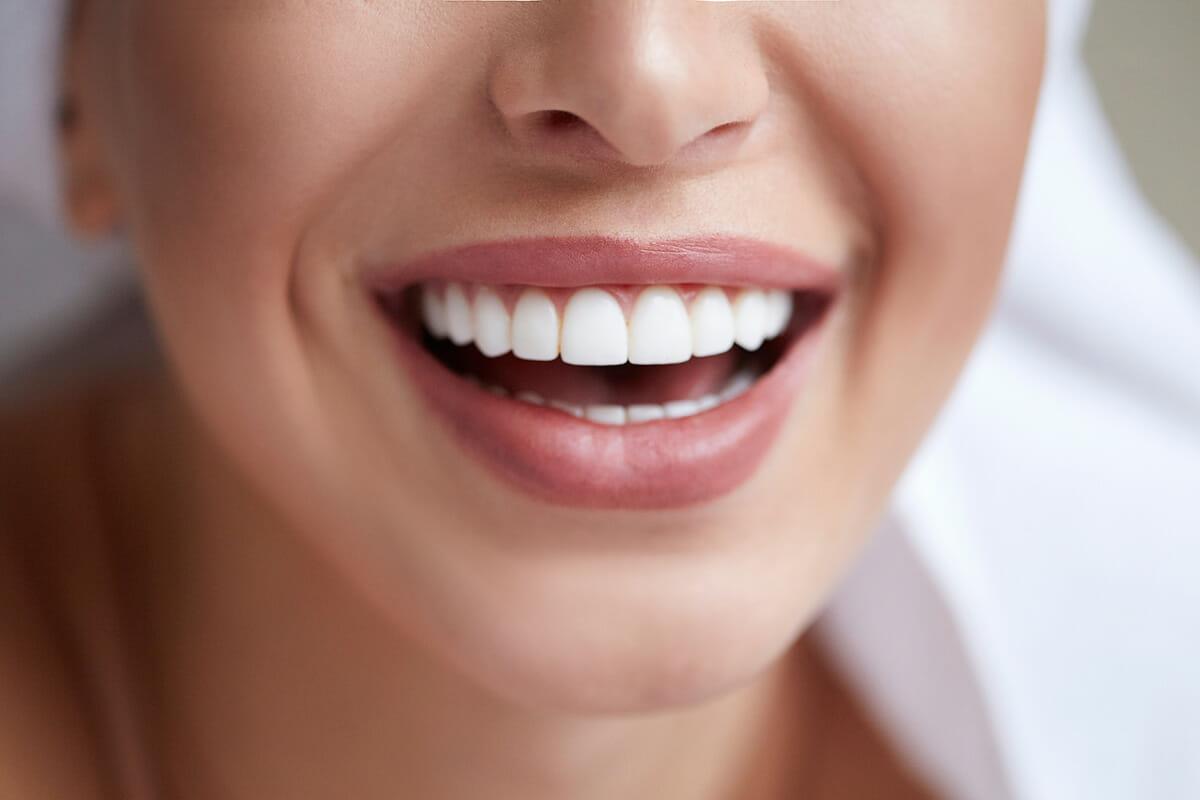 Smile Makeover Consultations