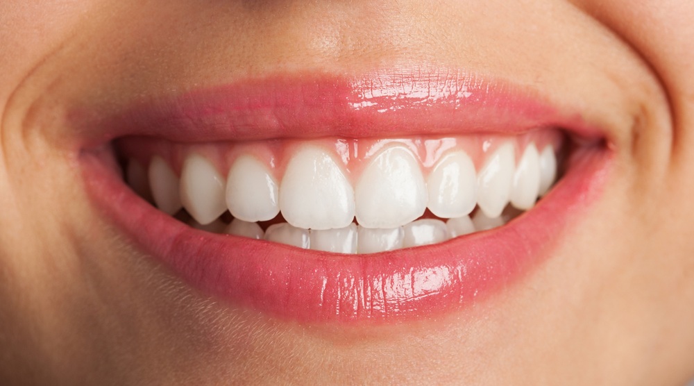 Teeth Whitening Consultation in Wilmington
