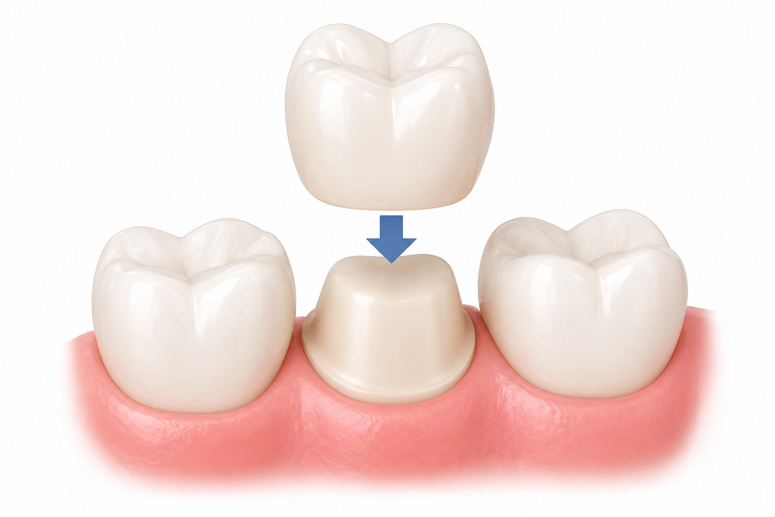 cosmetic dental treatment in North Carolina - O2 Dental Group - O2 Dental Group cosmetic dental treatment in North Carolina