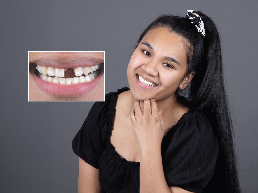 dental implant consultation Southern Pines NC - O2 Dental Group - O2 Dental Group dental implant consultation Southern Pines NC