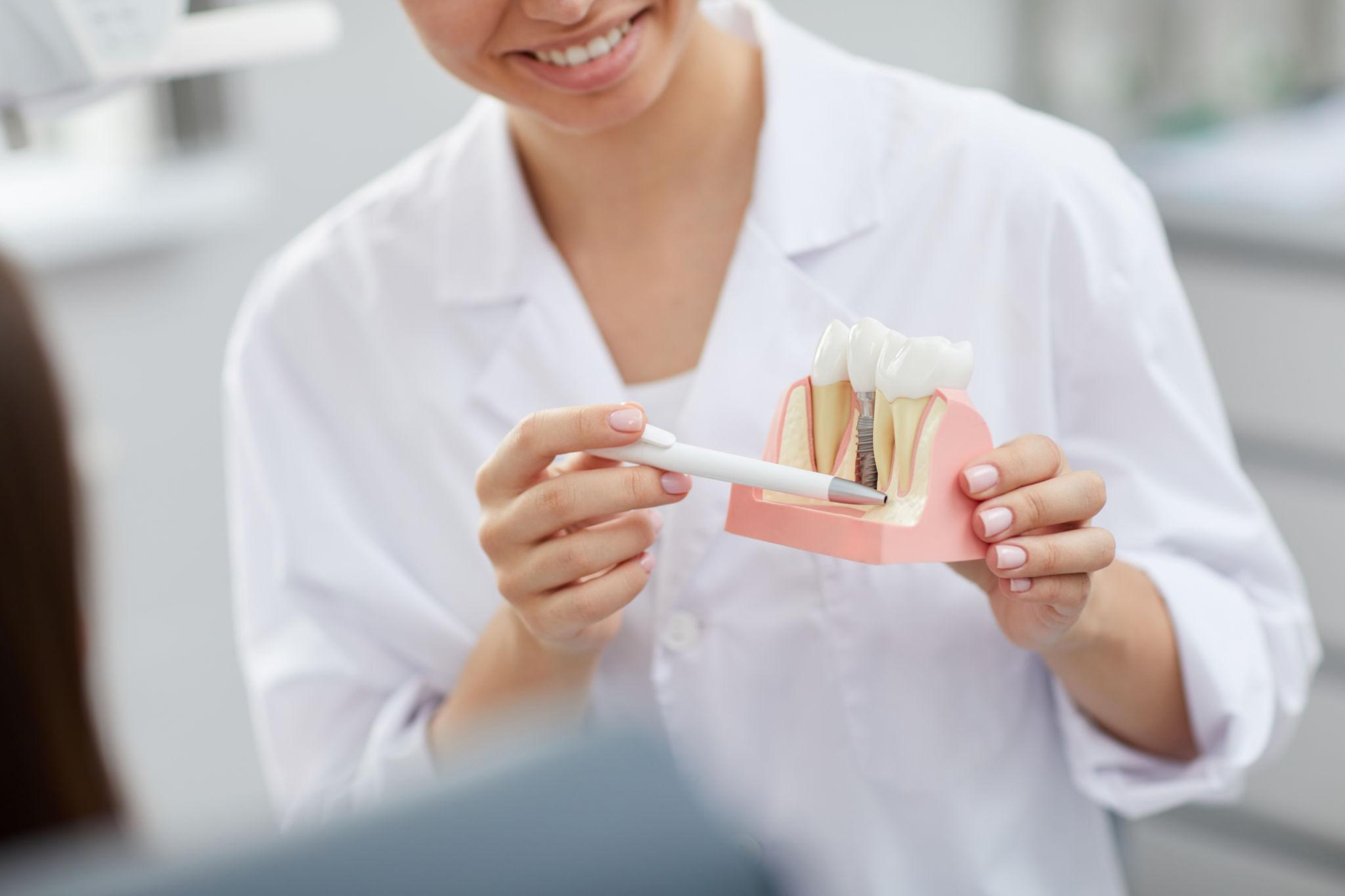 dental implants Fayetteville