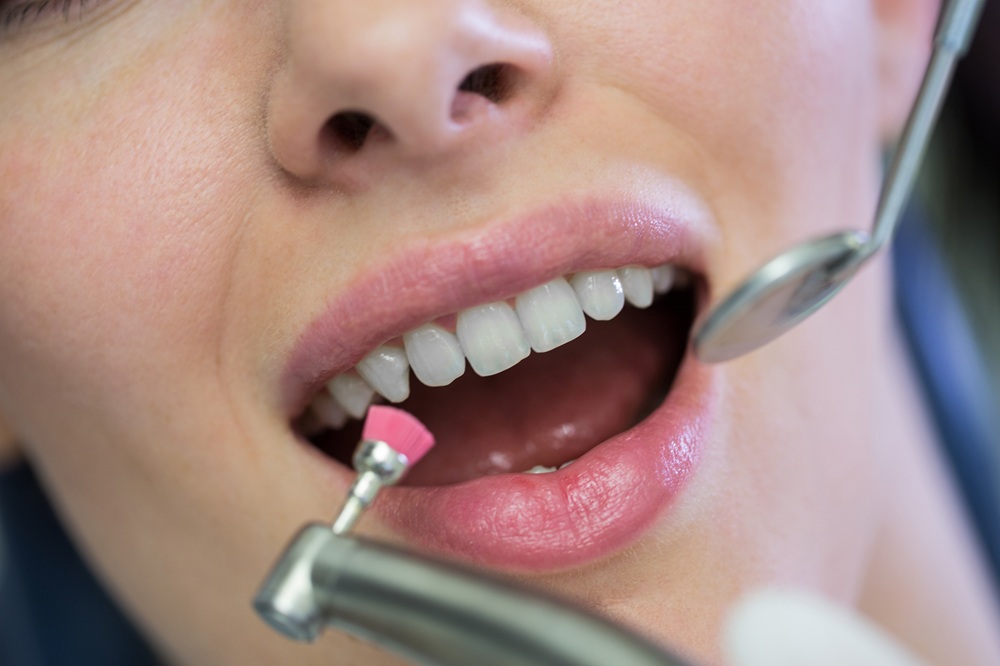 Teeth Whitening Treatment in Wilmington