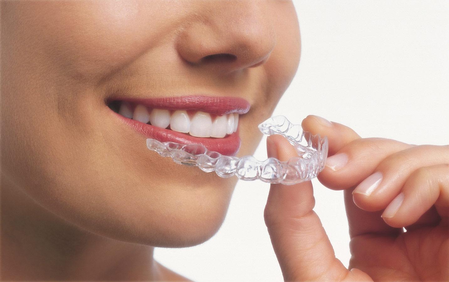 invisalign retainer replacement Raleigh NC