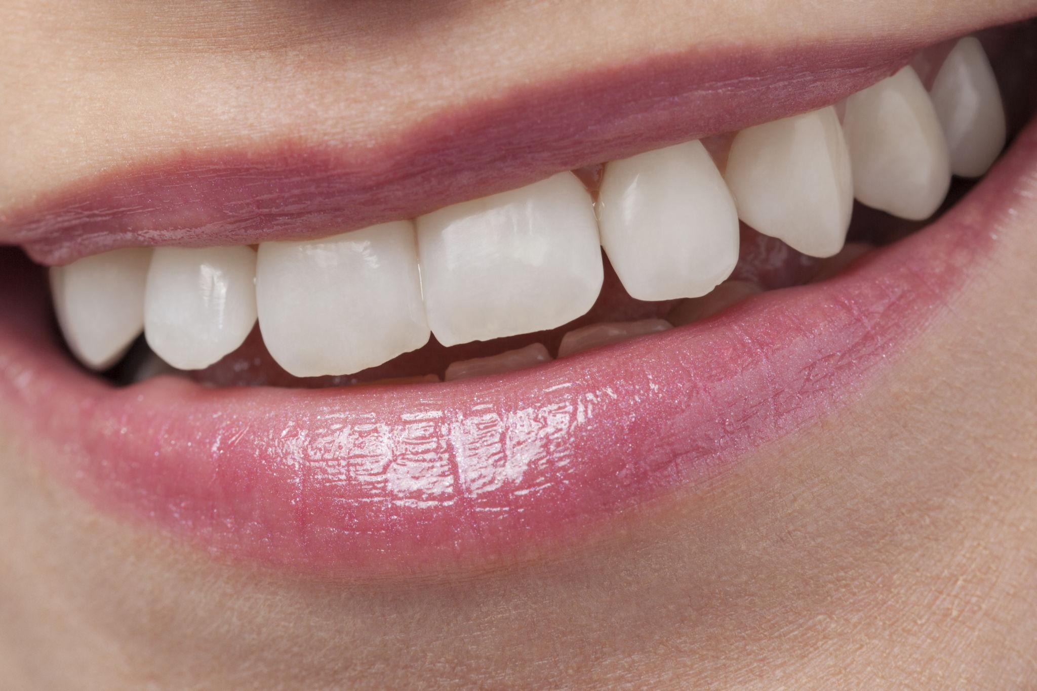 invisible dental aligners Wilmington NC - O2 Dental Group - O2 Dental Group invisible dental aligners Wilmington NC