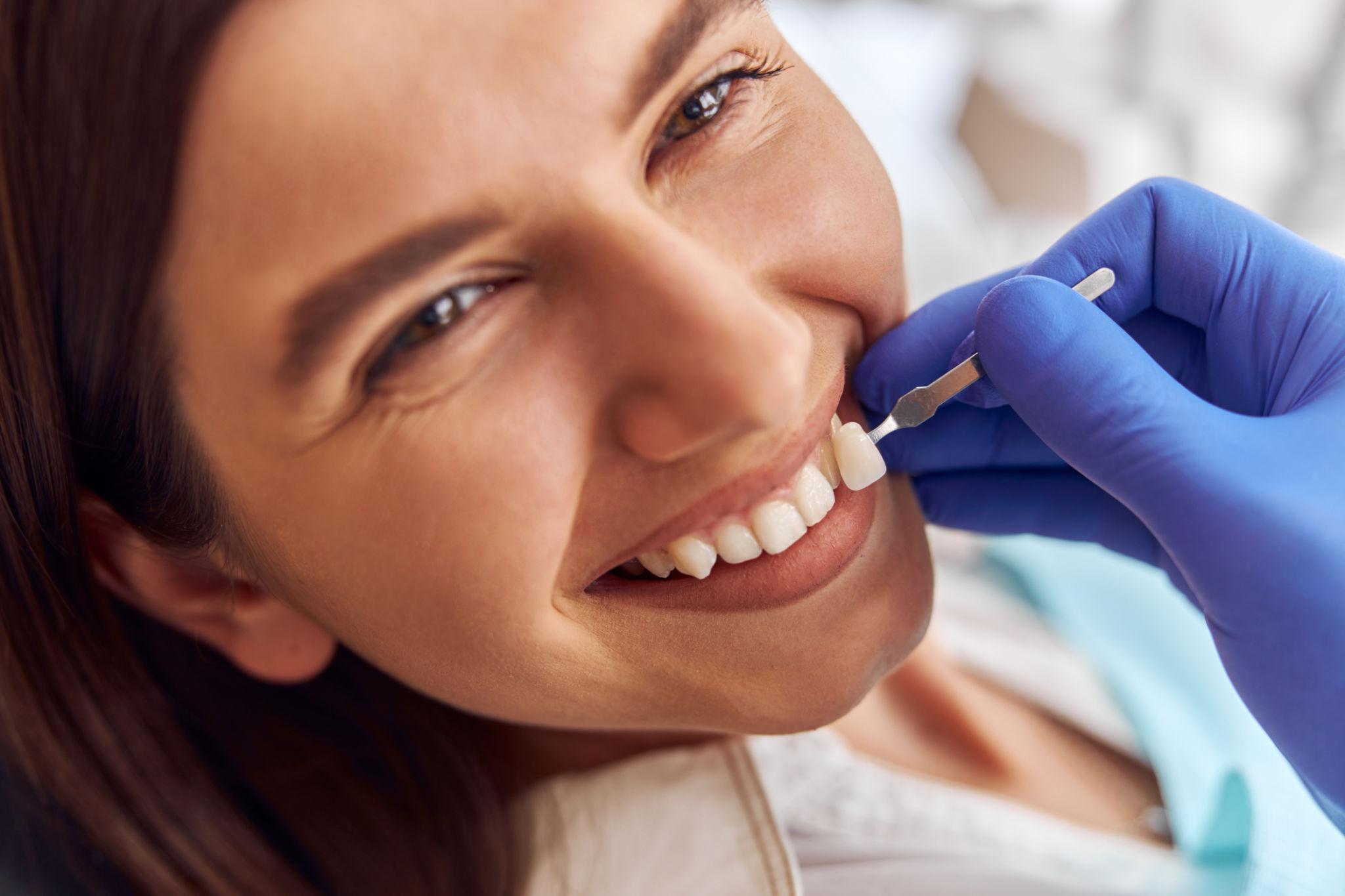 porcelain veneers consultation Siler City - O2 Dental Group - O2 Dental Group porcelain veneers consultation Siler City