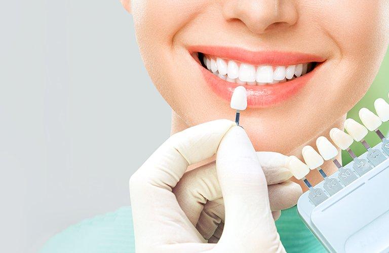 - O2 Dental Group - O2 Dental Group porcelain veneers in Durham NC