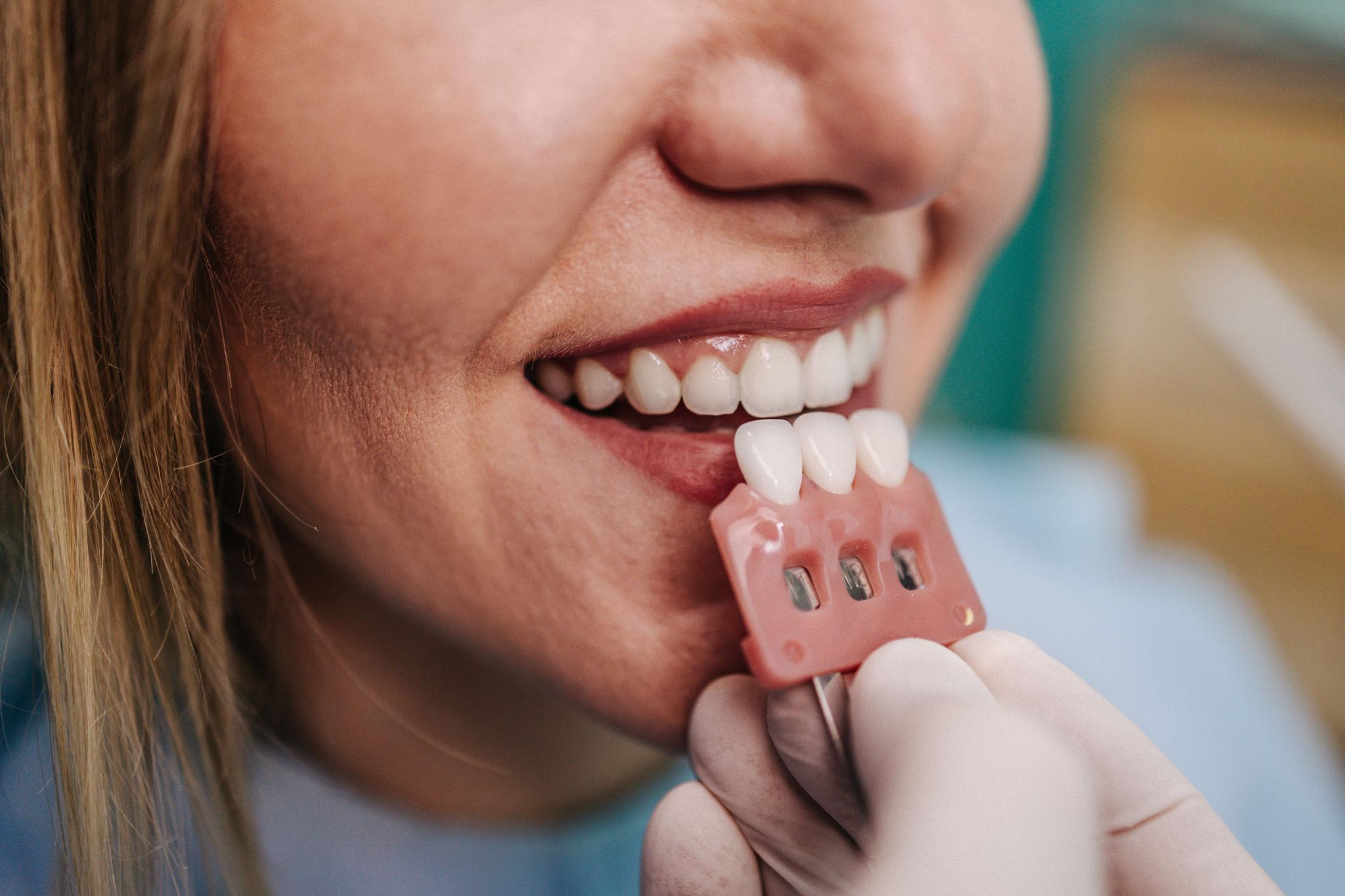 porcelain veneers treatment Southern Pines NC
