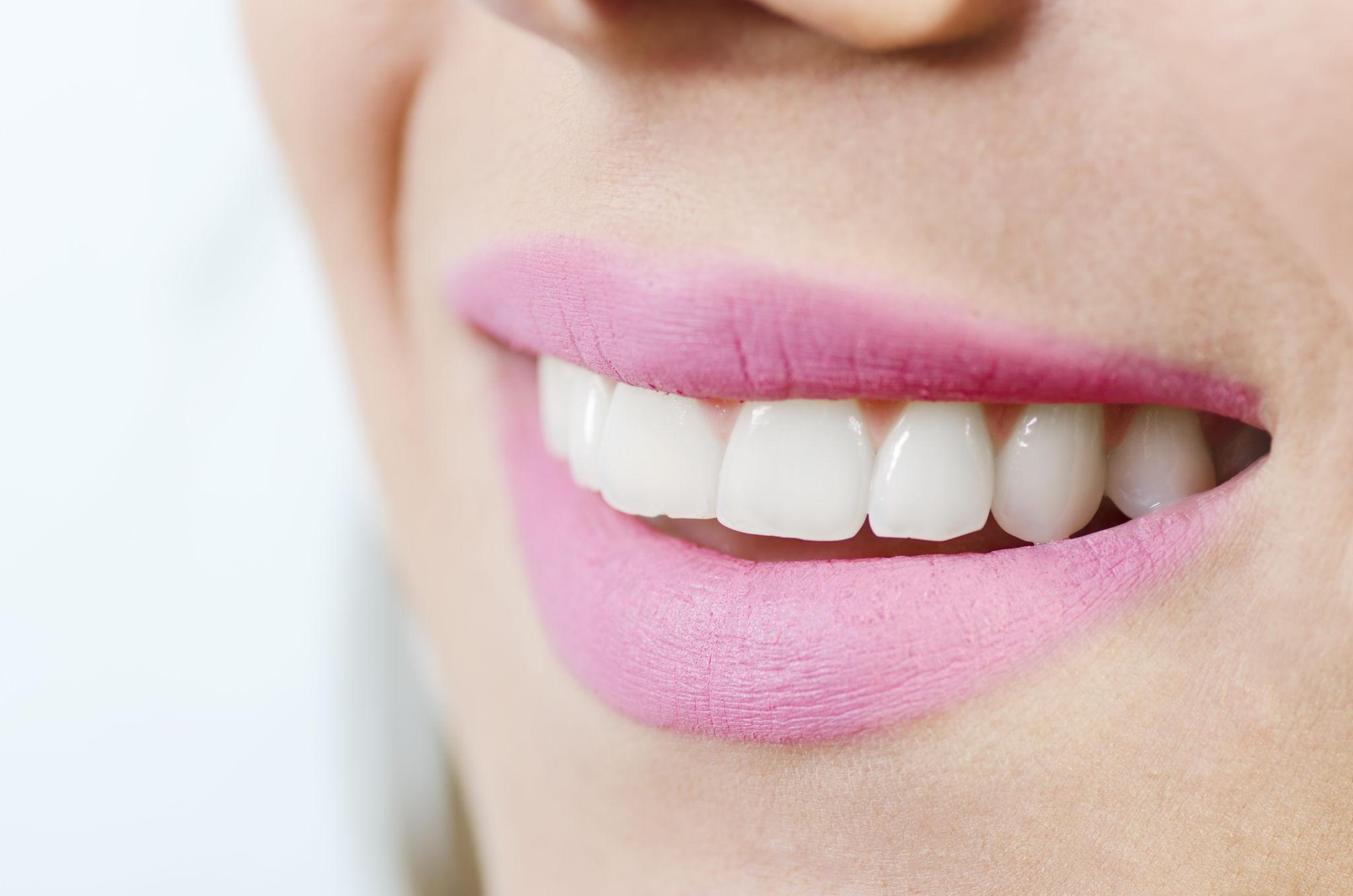 porcelain veneers treatment Wilmington NC - O2 Dental Group - O2 Dental Group porcelain veneers treatment Wilmington NC