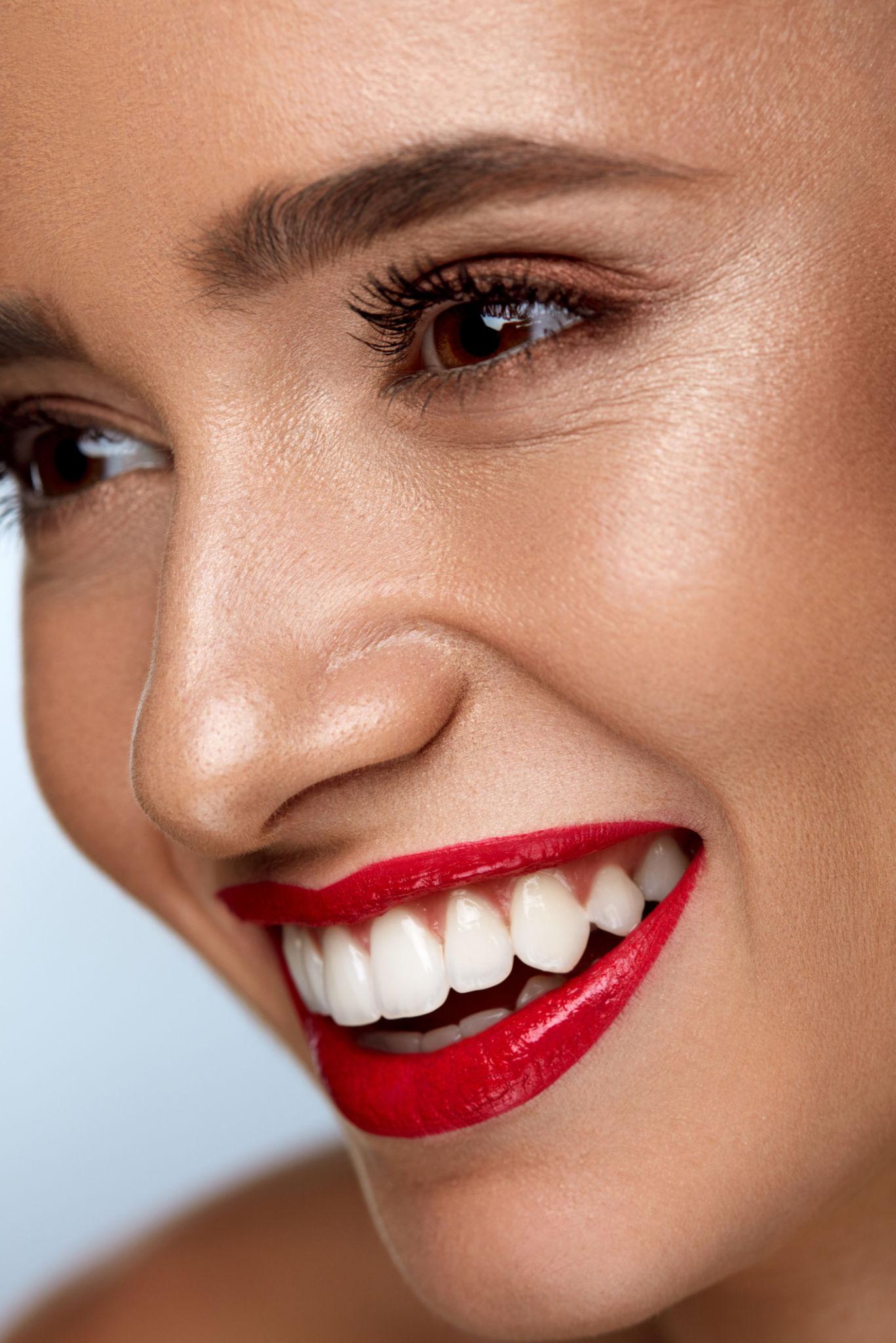 porcelain veneers treatment Wilmington NC - O2 Dental Group - O2 Dental Group porcelain veneers treatment Wilmington NC