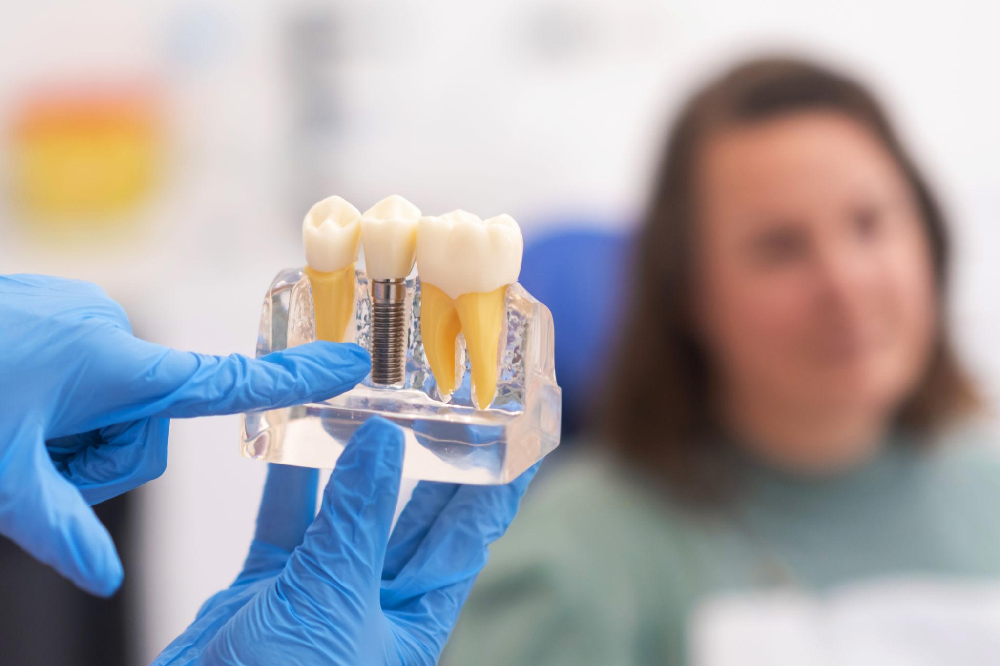 professional dental implants Siler City NC - O2 Dental Group - O2 Dental Group professional dental implants Siler City NC