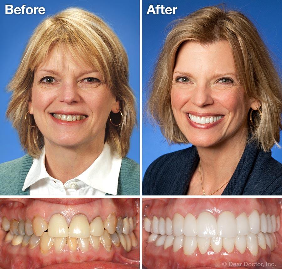 - O2 Dental Group - O2 Dental Group cosmetic dentistry in Durham NC