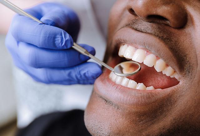 All-on-4 Full-Arch Implants in North Carolina