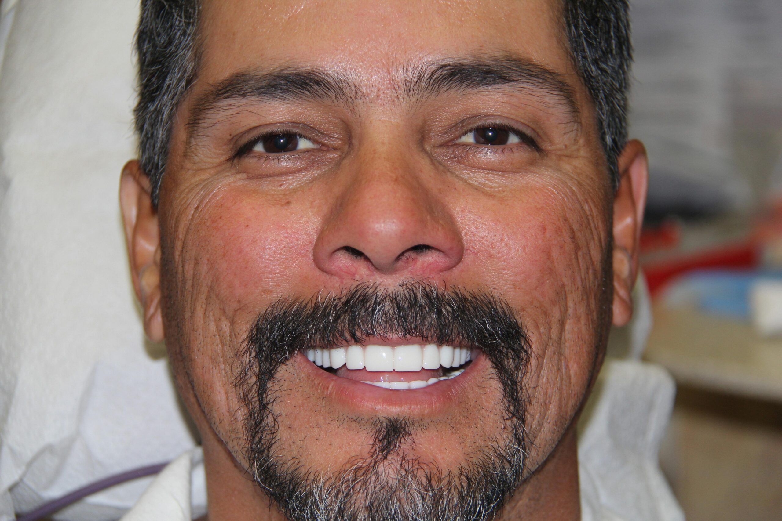 All-on-4 Full-Arch Implants in Raleigh, NC