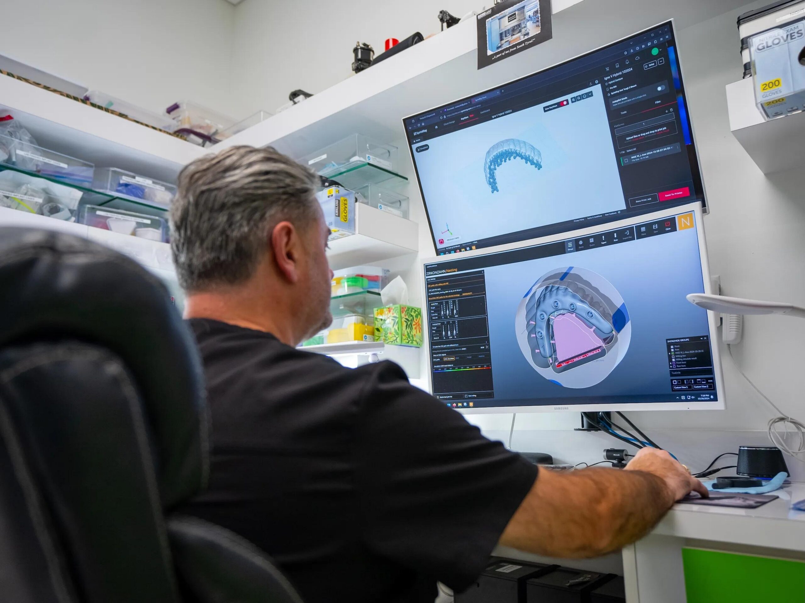 All-on-4 Full-Arch Implants Consultation in Southern Pines