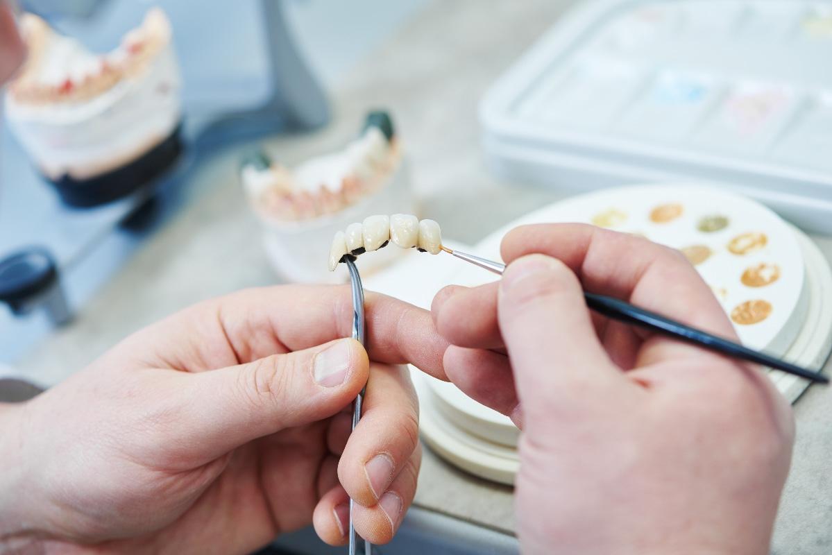 Dental Bridges Consultation in Southern Pines NC
