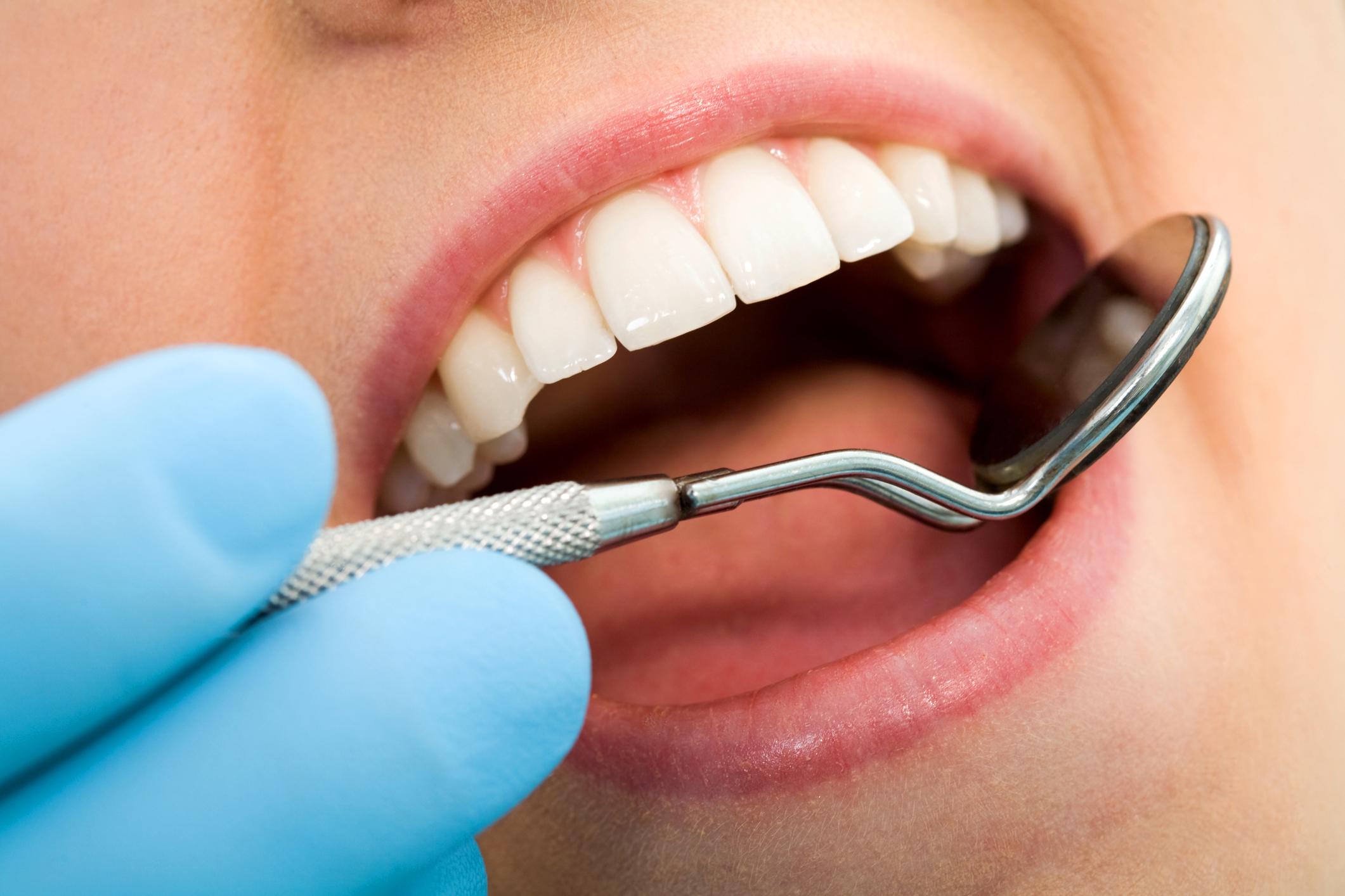 Gum Disease Treatment in Durham NC 2