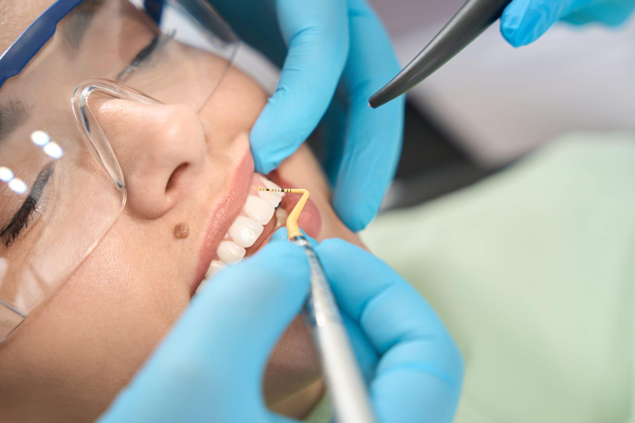 Gum Disease Treatment in Durham NC 4