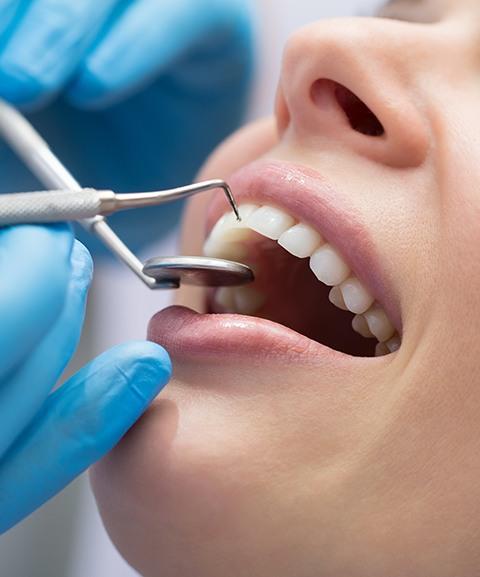 Gum Disease Treatment in Southern Pines NC 1