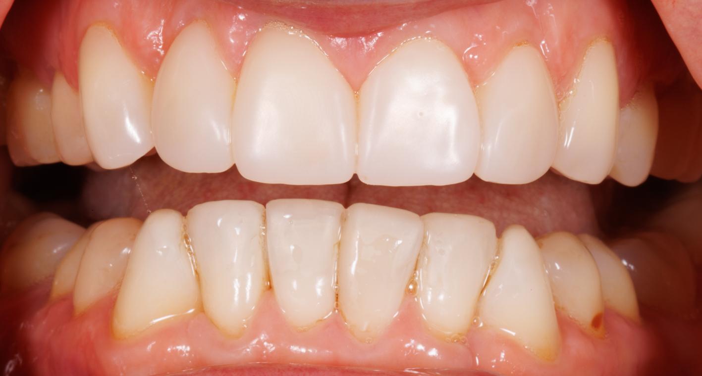 Preventive Dentistry in Durham