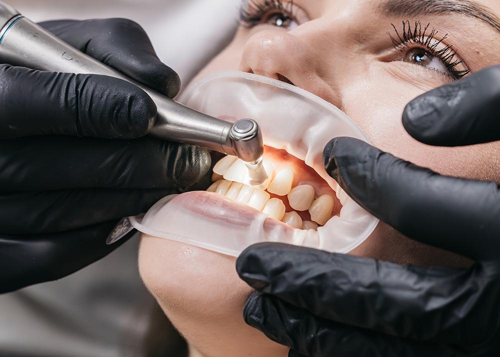 Preventive Dentistry in Raleigh NC-