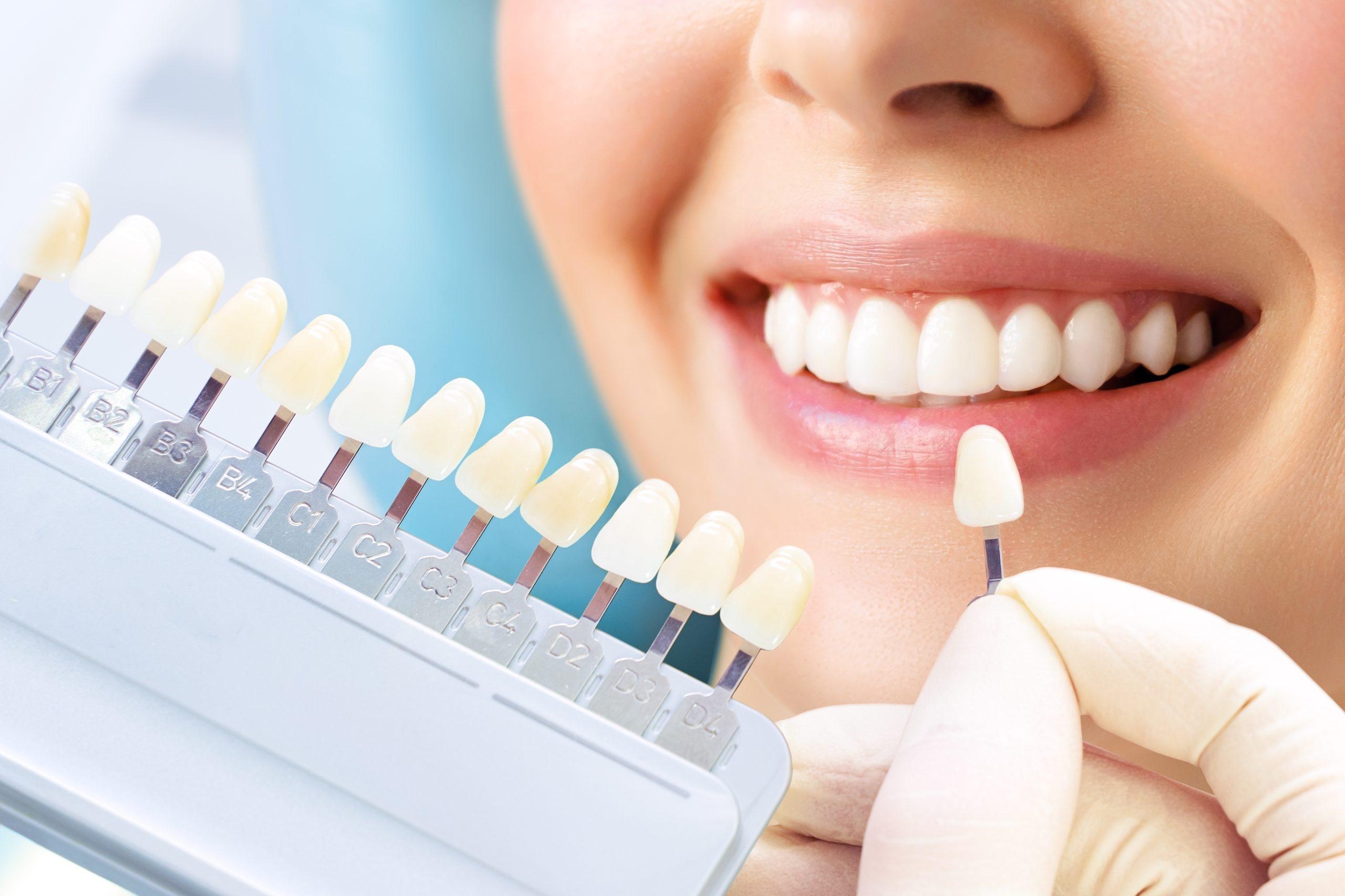 Cosmetic Dentistry in Durham, NC