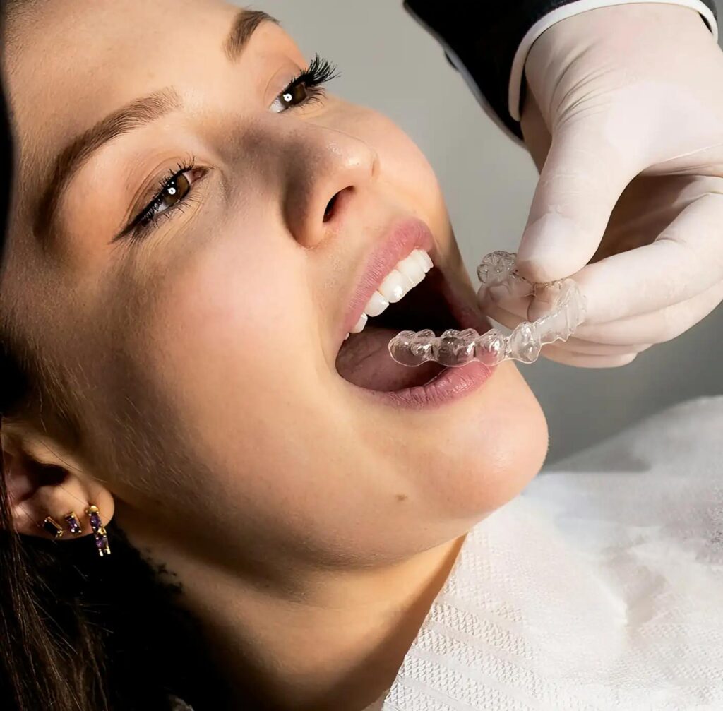 Invisalign y alineadores transparentes fayetteville