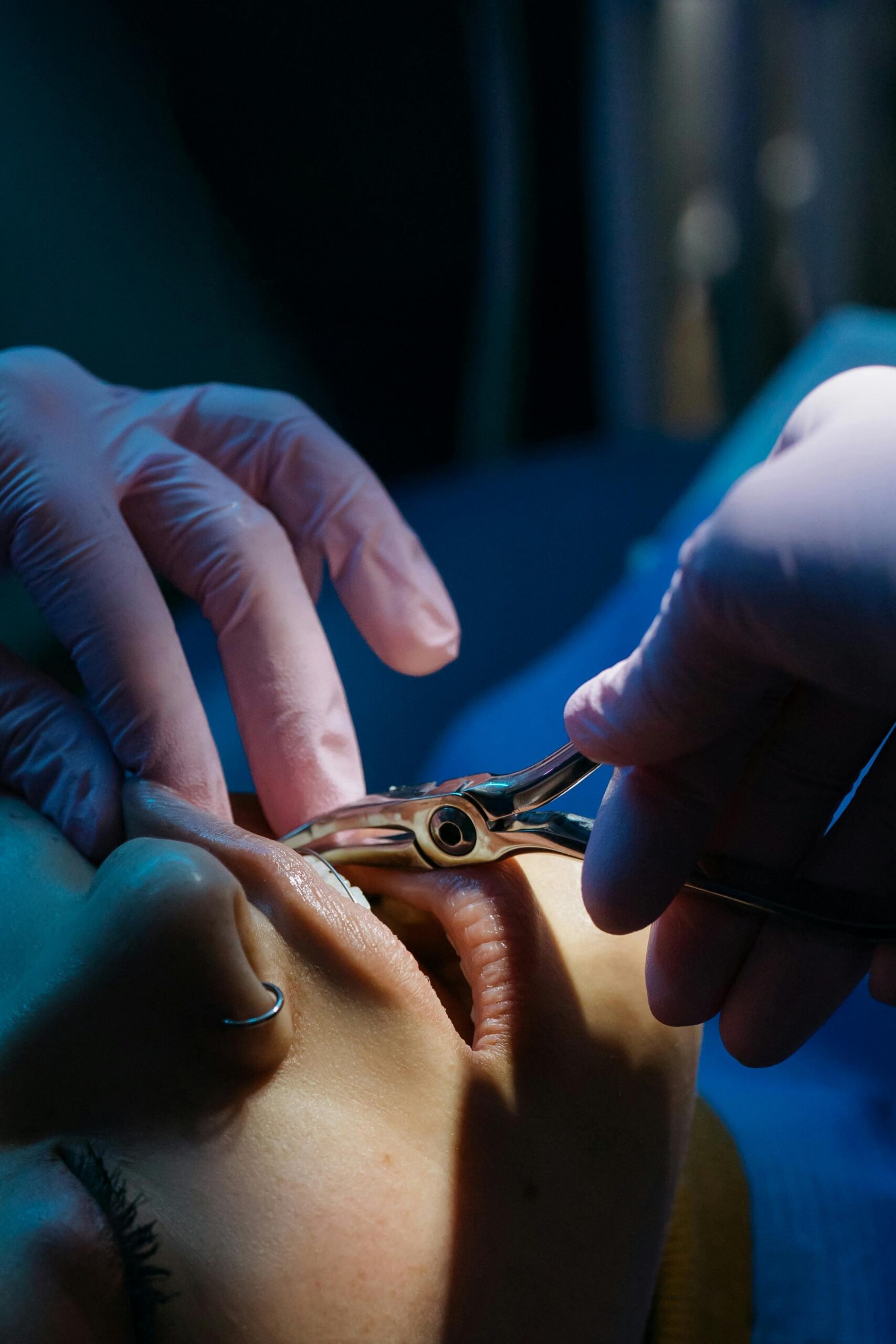 Tooth Extraction in North Carolina
